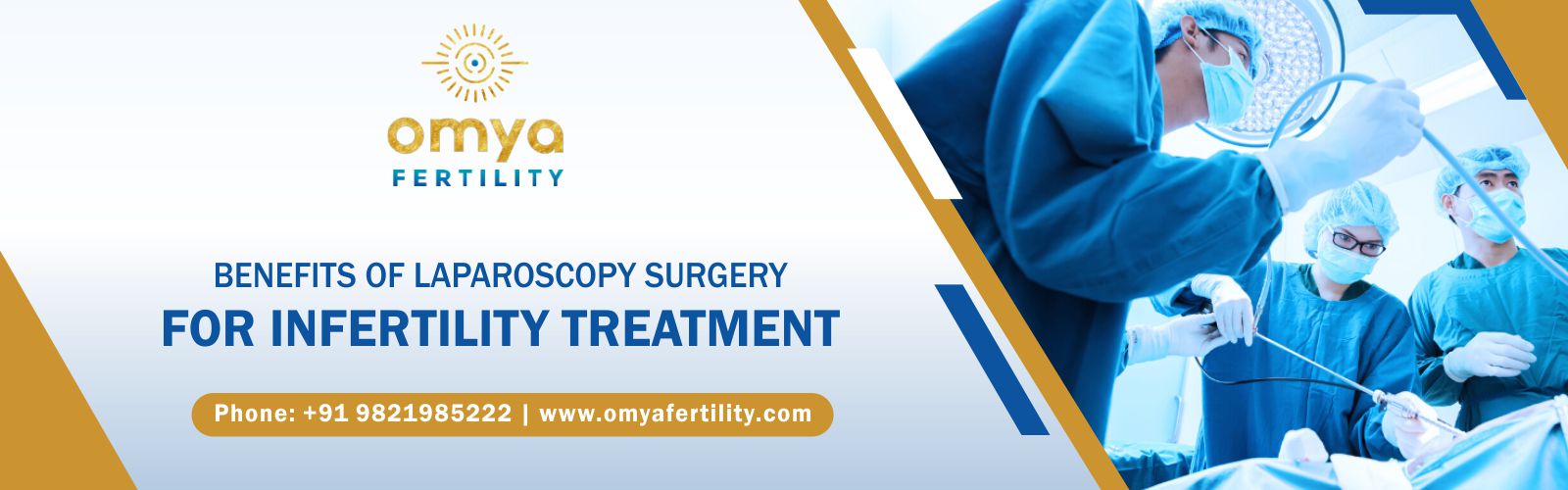 Laparoscopy Surgery For Infertility Treatment & Blocked Fallopian Tubes: What To Expect?